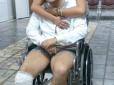 Ветеран АТО змушений три роки в судах доводити, що втратив ногу на війні