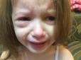 Дівчинка ледь не втратила око: У дитсадку Дніпра трапився моторошний інцидент (фото)