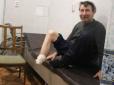 Хіти тижня. Жах та й годі: Через гангрену українець сам собі відрізав ногу, бо не міг заплатити лікарям (відео 12+)
