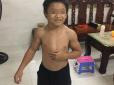 10-річний хлопчик вражає м'язистим тілом, але це не пов'язано з фізичними вправами (фото)