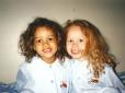 Іноді природа жартує: У мережі показали, як зараз виглядають сестри-близнючки, які народилися з різним кольором шкіри (фото)