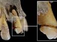 Гендерний поділ праці, або Інструменти в роті: Аналіз зубів показав, чим займалися жінки в стародавній Іспанії
