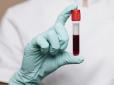 Кілька дивовижних секретів, які група крові може розповісти про ваше здоров'я