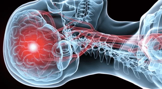 Не ігноруйте! Невидимі сигнали серця: 99% людей мали  ці попереджувальні ознаки за роки до інсульту